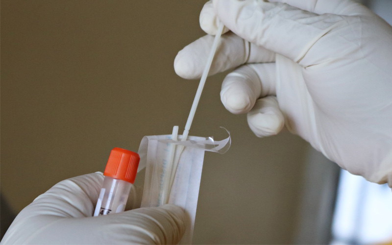 [Covid Antigen Test]